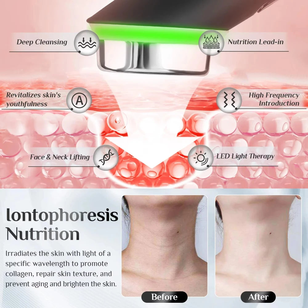 Age-R Booster Facial Device