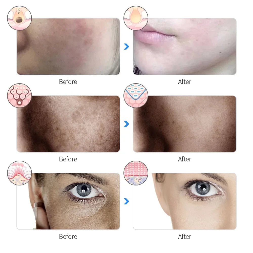 Rechargeable LED Photon Face Mask